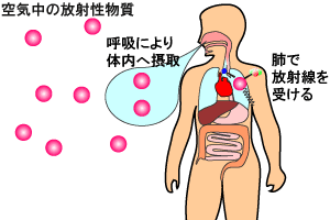 画像：空気中の放射性物質を吸入することにより受ける放射線のイメージ