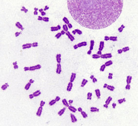 画像：人間(女性)の正常な染色体